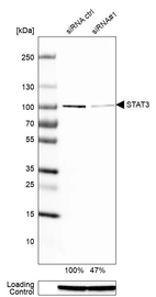 Western blot analysis in RT-4 cells transfected with control siRNA, target specific siRNA probe #1, using Anti-STAT3 antibody. Remaining relative intensity is presented. Loading control: Anti-GAPDH.