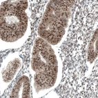 Immunohistochemical staining of human endometrium shows strong nuclear and moderate cytoplasmic positivity in glandular cells.