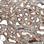 Immunohistochemical staining of human kidney shows strong nuclear and moderate cytoplasmic positivity in cells in tubules.