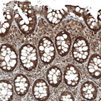 Immunohistochemical staining of human rectum shows moderate to strong nuclear and cytoplasmic positivity in glandular cells.