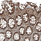 Immunohistochemical staining of human rectum shows moderate to strong nuclear and cytoplasmic positivity in glandular cells.