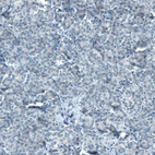 Immunohistochemical staining of human pancreas shows no positivity in exocrine glandular cells as expected.