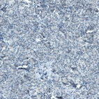 Anti-STAT3 Antibody