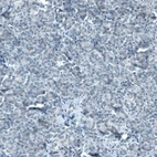 Immunohistochemical staining of human pancreas shows no positivity in exocrine glandular cells as expected.
