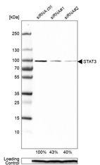 Western blot analysis in RT-4 cells transfected with control siRNA, target specific siRNA probe #1 and #2, using Anti-STAT3 antibody. Remaining relative intensity is presented. Loading control: Anti-PPIB.