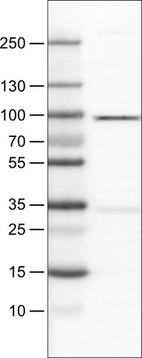 Lane 1: Marker [kDa]_br/_Lane 2: Human cell line RT-4