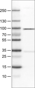 Lane 1: Marker [kDa]_br/_Lane 2: Human cell line RT-4