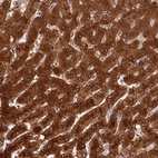 Immunohistochemical staining of human liver shows strong cytoplasmic positivity in hepatocytes.