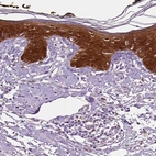 Immunohistochemical staining of human skin shows strong cytoplasmic positivity in squamous epithelial cells.