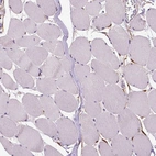 Immunohistochemical staining of human skeletal muscle shows no positivity in myocytes as expected.