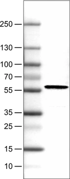 Lane 1: Marker [kDa]_br/_Lane 2: Human cell line RT-4