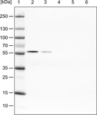 Lane 1: Marker [kDa]_br/_Lane 2: Human cell line HeLa cytoplasmic fraction_br/_Lane 3: Human cell line HeLa membrane fraction_br/_Lane 4: Human cell line HeLa nuclear fraction_br/_Lane 5: Human cell line HeLa chromatin fraction_br/_Lane 6: Human cell line HeLa cytoskeletal fraction