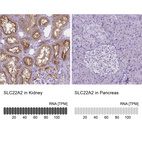 Anti-SLC22A2 Antibody