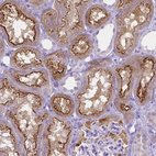 Immunohistochemical staining of human kidney show strong positivity in apical membrane in cells in tubules.