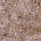 Anti-SLC22A2 Antibody