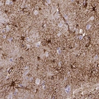 Immunohistochemical staining of human cerebral cortex shows strong membranous positivity in astrocytes.