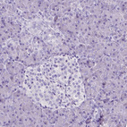 Anti-SLC22A2 Antibody