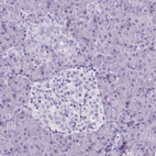 Immunohistochemical staining of human pancreas shows no positivity in either exocrine or endocrine glandular cells as expected.