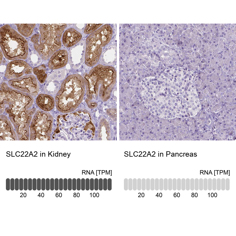 Anti-SLC22A2 Antibody