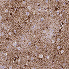 Anti-SLC22A2 Antibody