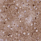 Immunohistochemical staining of human cerebral cortex shows strong membranous positivity in astrocytes.