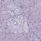 Immunohistochemical staining of human pancreas shows no positivity in either exocrine or endocrine glandular cells as expected.