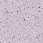Immunohistochemical staining of human cerebral cortex shows moderate to strong nuclear positivity in a subset of glial cells.