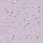 Anti-SOX9 Antibody