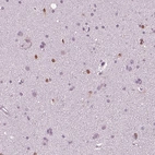 Immunohistochemical staining of human cerebral cortex shows moderate to strong nuclear positivity in a subset of glial cells.