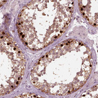 Immunohistochemical staining of human testis shows strong nuclear positivity in a subset of cells in seminiferous ducts.