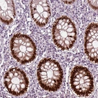 Immunohistochemical staining of human colon shows moderate to strong nuclear positivity in glandular cells.