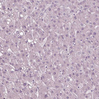 Anti-SOX9 Antibody