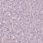 Immunohistochemical staining of human liver shows no nuclear positivity in hepatocytes as expected.