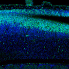 Anti-SOX9 Antibody