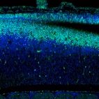 Immunofluorescence staining of mouse embryo E11 shows moderate to strong positivity in the developing neural tube.