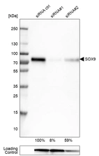 Western blot analysis in U-251MG cells transfected with control siRNA, target specific siRNA probe #1 and #2, using Anti-SOX9 antibody. Remaining relative intensity is presented. Loading control: Anti-GAPDH.