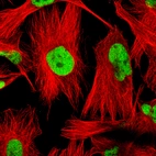 Immunofluorescence staining of U-251 cells using the anti-SOX9 monoclonal antibody, showing specific staining in the nucleoplasm in green. Microtubule- and nuclear probes are visualized in red and blue, respectively (where available).