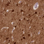 Immunohistochemical staining of human cerebral cortex shows strong cytoplasmic positivity in neurons.