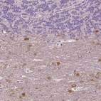 Immunohistochemical staining of human cerebellum shows moderate cytoplasmic positivity in neurons.