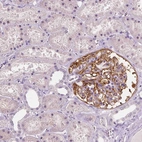 Immunohistochemical staining of human kidney shows strong cytoplasmic positivity in cells in glomeruli.