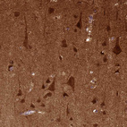 Immunohistochemical staining of human cerebral cortex shows strong cytoplasmic positivity in neurons.