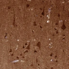 Immunohistochemical staining of human cerebral cortex shows strong cytoplasmic positivity in neurons.