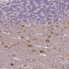 Immunohistochemical staining of human cerebellum shows moderate cytoplasmic positivity in neurons.