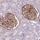 Immunohistochemical staining of human kidney shows strong cytoplasmic positivity in cells in glomeruli.