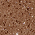 Anti-NECAB1 Antibody