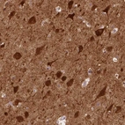 Immunohistochemical staining of human cerebral cortex shows strong cytoplasmic positivity in neurons.