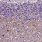 Immunohistochemical staining of human cerebellum shows moderate cytoplasmic positivity in neurons.