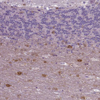 Anti-NECAB1 Antibody