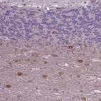 Immunohistochemical staining of human cerebellum shows moderate cytoplasmic positivity in neurons.