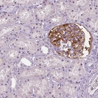 Immunohistochemical staining of human kidney shows strong cytoplasmic positivity in cells in glomeruli.